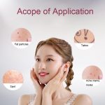 FY-106 Tragbarer Stift zur Entfernung von Muttermalen und Sommersprossen Haushaltslaser-Schönheitsgerät, FY-106 (Rose Gold), FY-106 (Gold), FY-106 (Green), FY-106 (Blue) – Bild 10