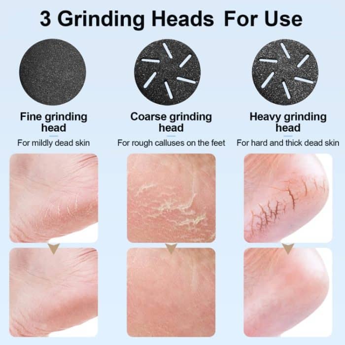 JD-510 Wiederaufladbarer elektrischer Hornhautentferner mit Staubsauger, White, 10 In 1 Kit White, Black, 10 In 1 Kit  Black – Bild 4