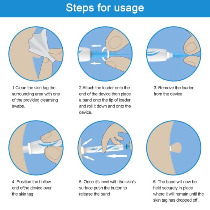 2 IN 1 Auto Skin Tag Remover Gerät Adult Mole Wart Remover Gesichtspflege Beauty Tools – Bild 6