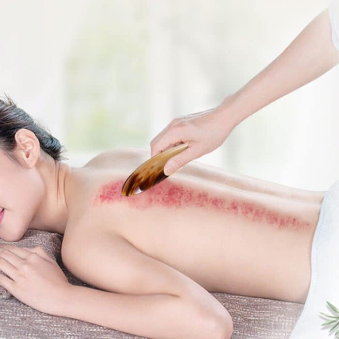 Kleine Hornröhre mit rundem Punkt-Scratch-Akupunkturstab, Farbe zufällige Lieferung – Bild 6