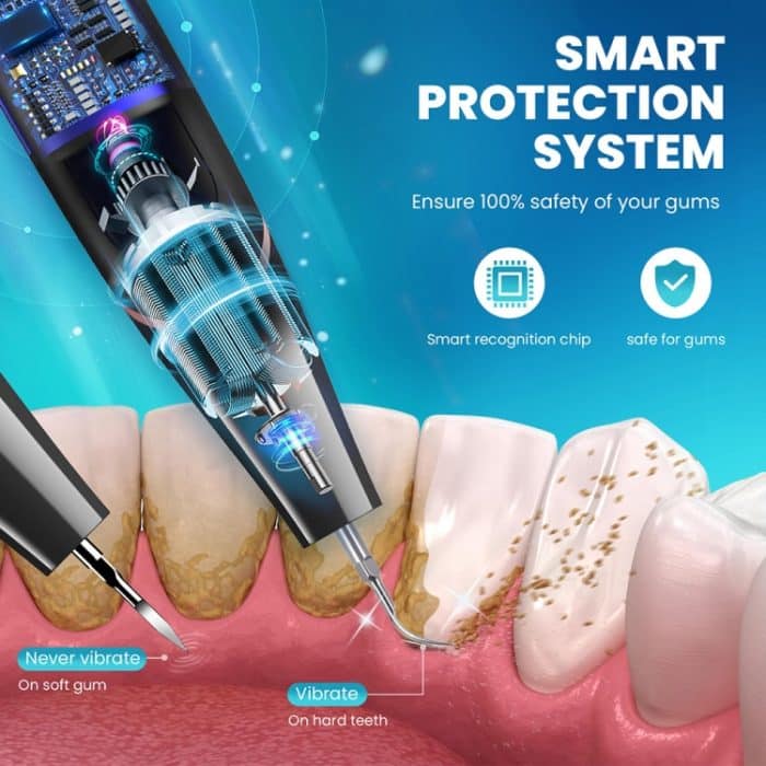 Ultraschall-Zahnsteinentfernungs-Zahnsteinentferner, Heim-Zahnreinigungsinstrument – Bild 4