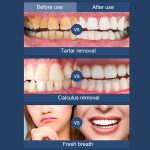 Ultraschall-Elektro-Scaler Home Dental Cleaner Tragbares Scaling-Instrument – Bild 7