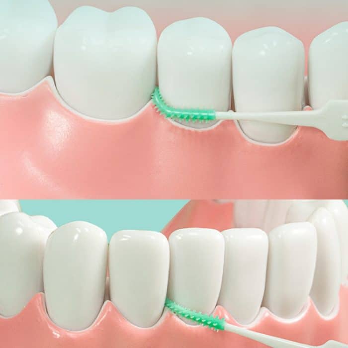 Fawnmum 150 Stück/Box Silikon Interdentalbürsten Zahnbürsten Zahnreinigung Zahnfleisch – Bild 8