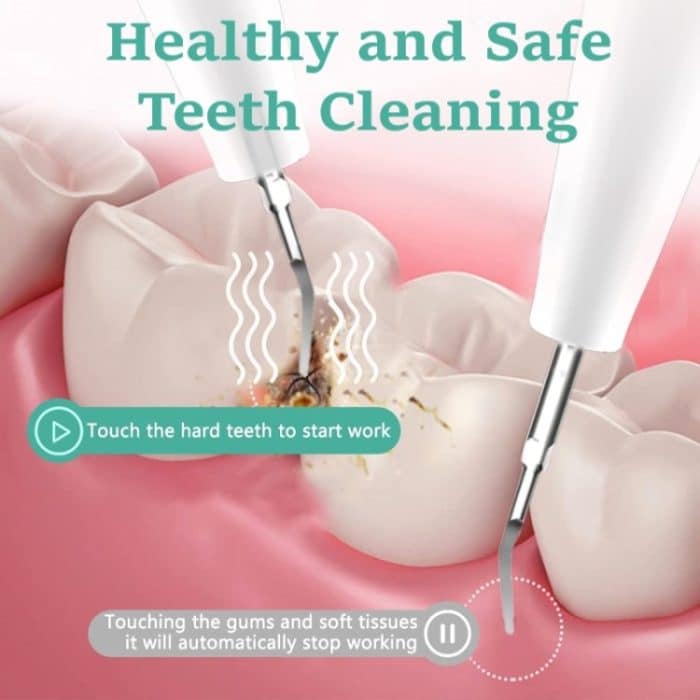 Elektrischer Ultraschall-Zahnsteinentferner, Zahnbelagreiniger, Zahnsteinentfernung mit LED-Licht, Package A, Package B, Package A with Accessories, Pacakge B with Accessories – Bild 3