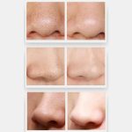 ZLY-018 Elektrisches Mitesser-Sauggerät für den Haushalt, Porenreinigungs- und Schönheitsausrüstung, ZLY-018 – Bild 7