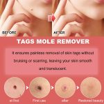 EELHOE 30 ml/Flasche Anti-Maulwurf- und Warzenflüssigkeit, Dark Spot Tag Remover Skin Essence – Bild 7