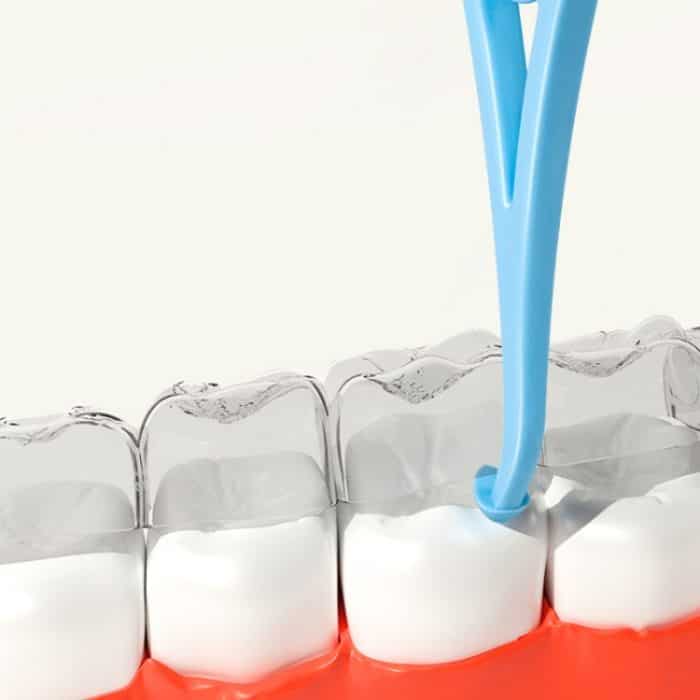 Fawnmum Zahnspangenentferner, unsichtbarer kieferorthopädischer Entfernungshaken – Bild 2