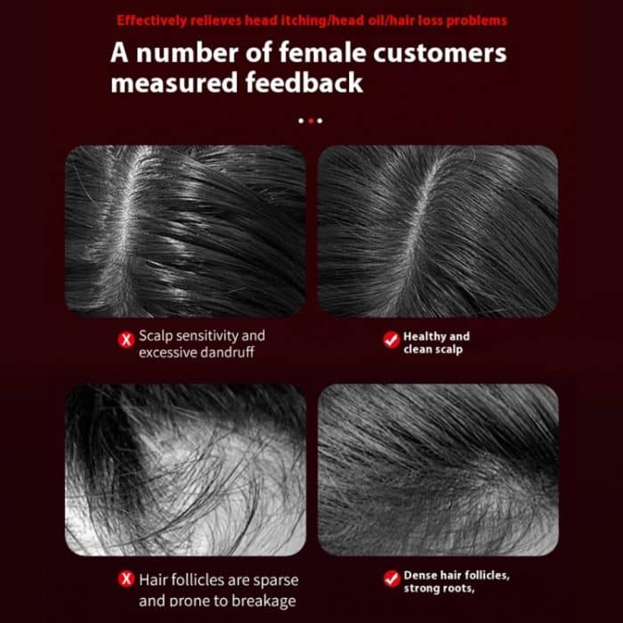 630nm Rotlicht Massagekamm Kopfhautpflege Flüssigkeitsführer Haarwuchsinstrument – Bild 9