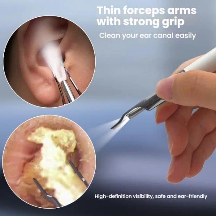 P5 Smart WIFI Connection Visible 10 Million Pixel HD Detachable Ear Spoon With APP – Bild 5