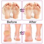 Elektrische Fußfeile, Geschwindigkeit einstellbar, Schleifpapierscheiben, Hornhautentferner, Pediküre, schnelles Entfernen von Füßen, harte, rissige, trockene, abgestorbene Haut, US plug, EU plug, UK plug – Bild 11