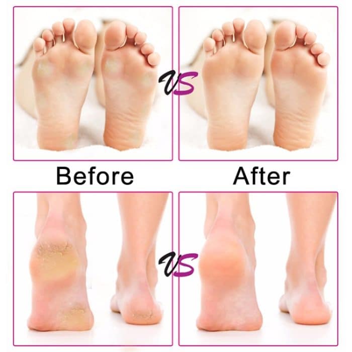 Elektrische Fußfeile, Geschwindigkeit einstellbar, Schleifpapierscheiben, Hornhautentferner, Pediküre, schnelles Entfernen von Füßen, harte, rissige, trockene, abgestorbene Haut, US plug, EU plug, UK plug – Bild 11