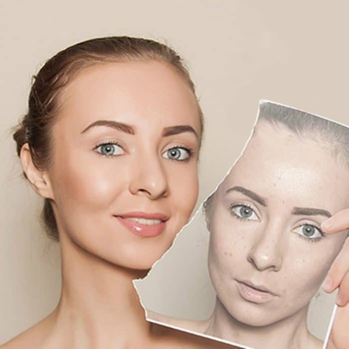 Professionelle Ultraschall Damen Hautpflege Whitening Sommersprossen Beauty Facial Machine – Bild 10