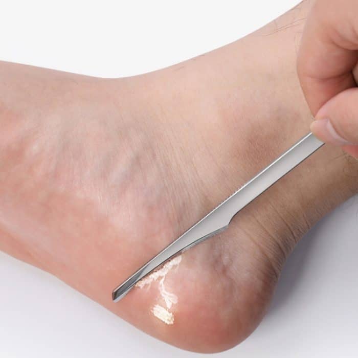 Pediküre Messer Spieß Nagelknipser Set Haushaltswerkzeuge zur Hornhautentfernung, Scraper, Diagonal Knife, Flat Knife, 3 In 1 – Bild 2