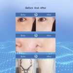 15 Gänge wiederaufladbarer Maulwurf-Spotting-Stift, Laser-Schönheitsinstrument, Fleckenentfernung, magisches Werkzeug – Bild 11