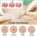 15 Gänge wiederaufladbarer Maulwurf-Spotting-Stift, Laser-Schönheitsinstrument, Fleckenentfernung, magisches Werkzeug – Bild 8