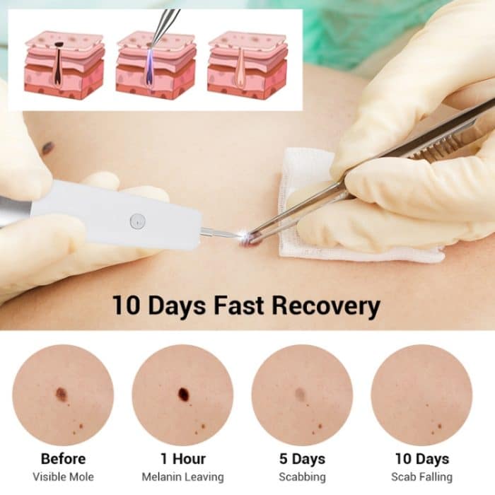 15 Gänge wiederaufladbarer Maulwurf-Spotting-Stift, Laser-Schönheitsinstrument, Fleckenentfernung, magisches Werkzeug – Bild 8